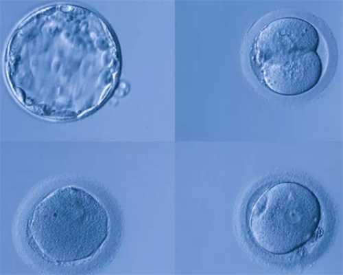 6周抽血验胎儿性别准吗？6周抽血验胎儿性别要注意什么？